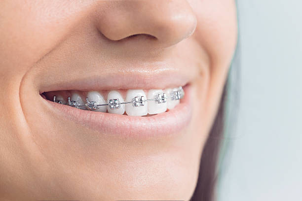 Best Invisalign and Clear Aligners  in Bradley, IL